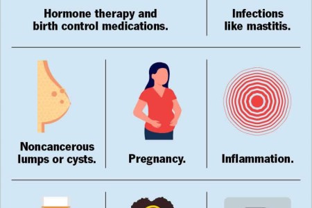 Breast Pain (Mastalgia)