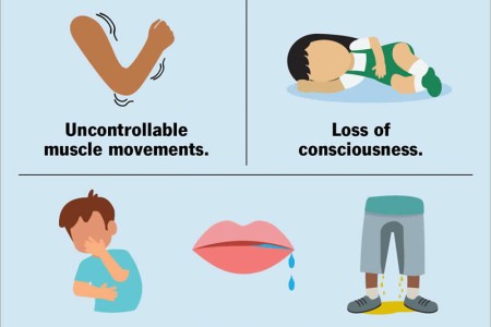 Febrile Seizure