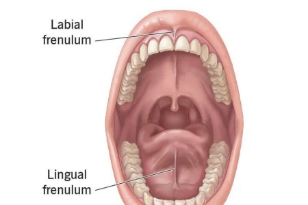 Frenum (Frenulum in Mouth)
