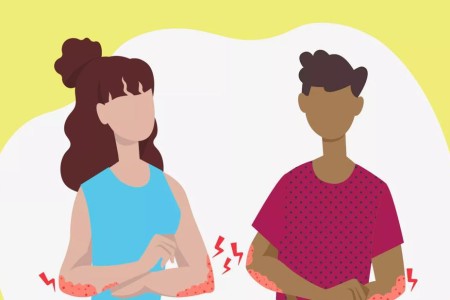 Why Atopic Dermatitis Itch Is So Intense — and How To Stop It