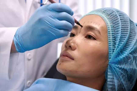 Facelift Facts: What You Need To Know