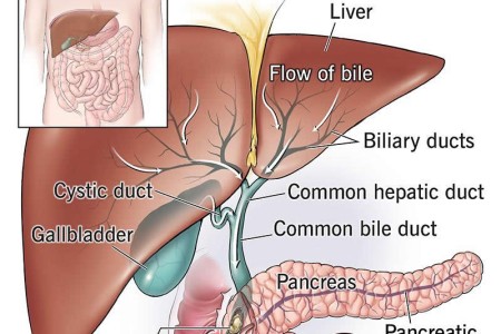 Bile Duct Obstruction