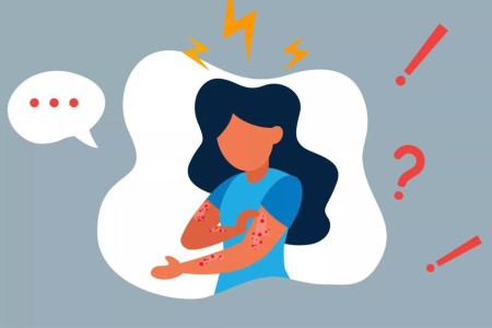 Eczema and Stress: What’s the Connection?