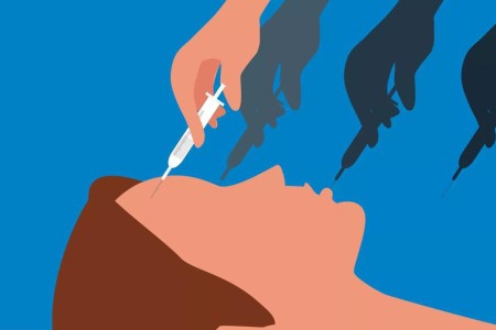 Botox Aftercare: The Do’s, Don’ts and Don’t-Worry-About-Its