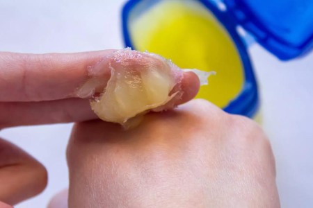 14 Psoriasis Self-Care Strategies