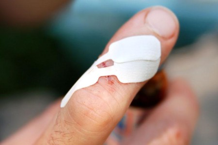 Steri-Strips (Butterfly Bandage)
