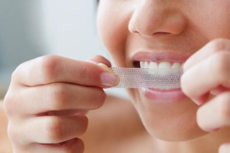 Are Teeth Whiteners Safe and Worth Trying?
