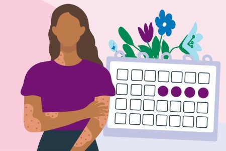Your Period and Chronic Hives: What To Know