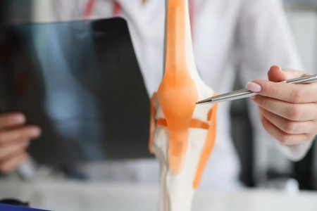 What Kind of Doctor Treats Arthritis?