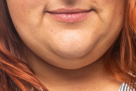 How Do I Get Rid of My Pesky Double Chin?