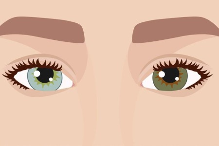 The Dangers of Eye Color-Change Surgery