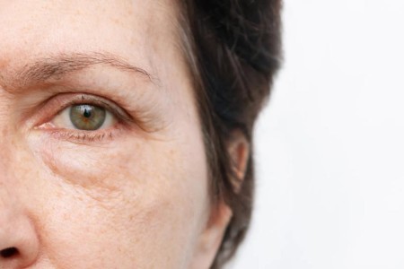 Puffy Eyes? How To Get Rid of Eye Bags