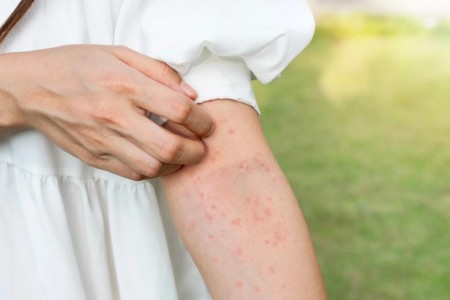 Things You May Not Know You Could Be Allergic To