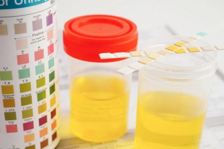 Home Menopause Tests Measure Hormones, but Are They Helpful?