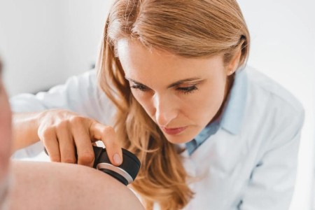 What To Know About Recurrent Melanoma