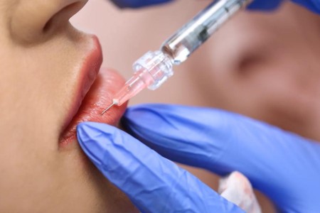 Lip Filler Aftercare: Do’s and Don’ts To Help You Heal