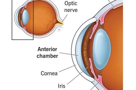 Anterior Chamber