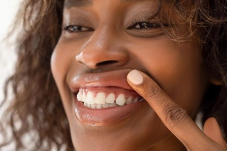 How To Know if Your Gums Are Healthy