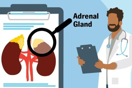 Here’s the Truth About ‘Adrenal Fatigue’