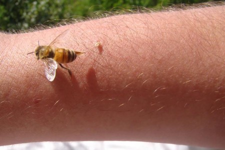 How To Remove a Bee Stinger
