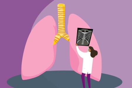 What’s the Difference Between Bronchitis and Pneumonia?