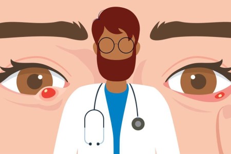 Chalazion vs. Stye: What’s That Bump on Your Eye?