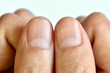 What Do the Half Moons on Your Nails Mean?
