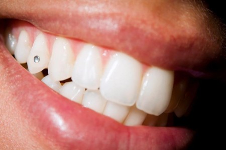 Are Tooth Gems Safe?