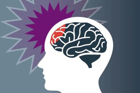 Is There a Connection Between Concussions and Parkinson’s Disease?