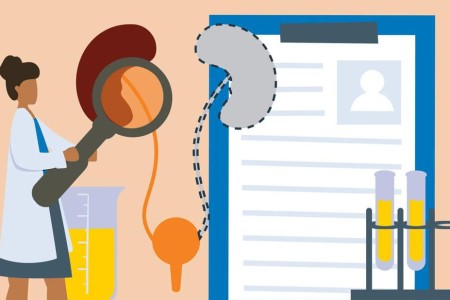 Can You Live With One Kidney?