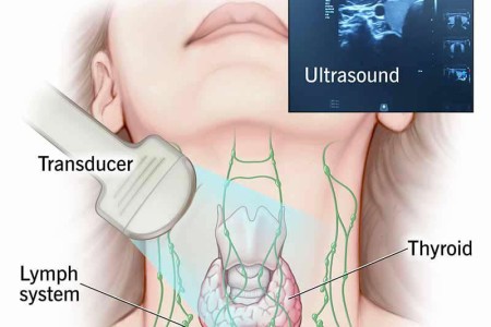 Thyroid Ultrasound