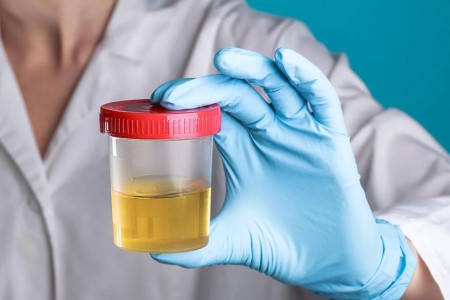 Is Pee Sterile? Here’s What the Science Says
