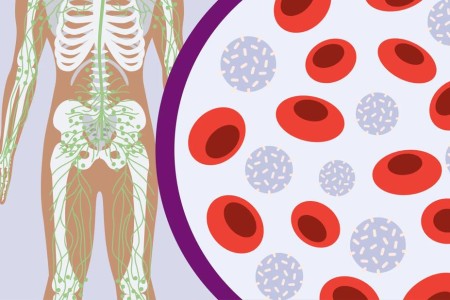 Leukemia vs. Lymphoma: Understanding the Difference