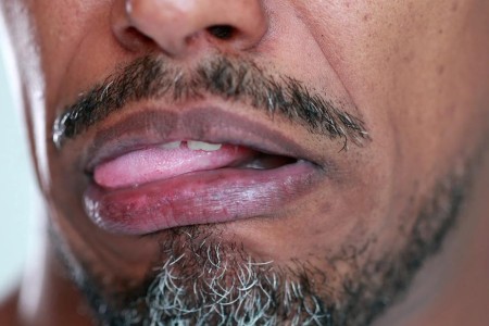 Sour Taste in Your Mouth? Here Are the 9 Most Common Causes