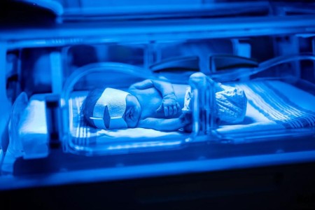 How Do You Know if Your Newborn’s Jaundice Is Serious?