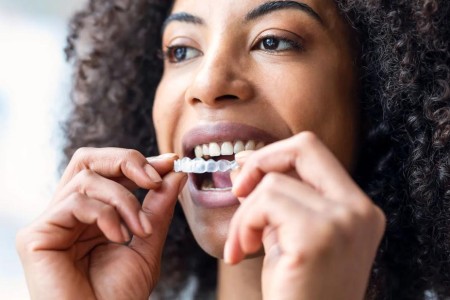 Can Adults Get Braces?