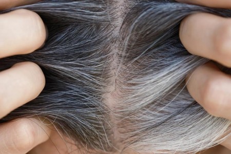 What Causes Gray Hair?