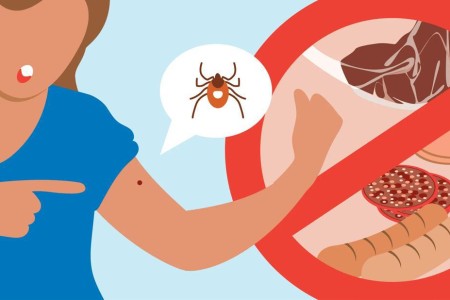 How a Tick Bite Can Make You Allergic to Meat