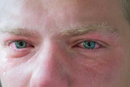 How To Get Rid of Swollen Eyes From Crying