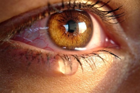 Tear Burns Are Irritating — Here’s What Causes Them