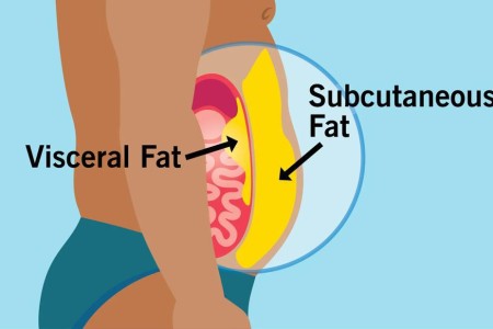 Visceral Fat vs. Subcutaneous Fat: What Are They?