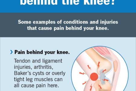 Back of Knee Pain (Posterior Knee Pain)
