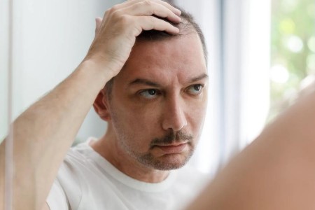 Can Ozempic Cause Hair Loss?